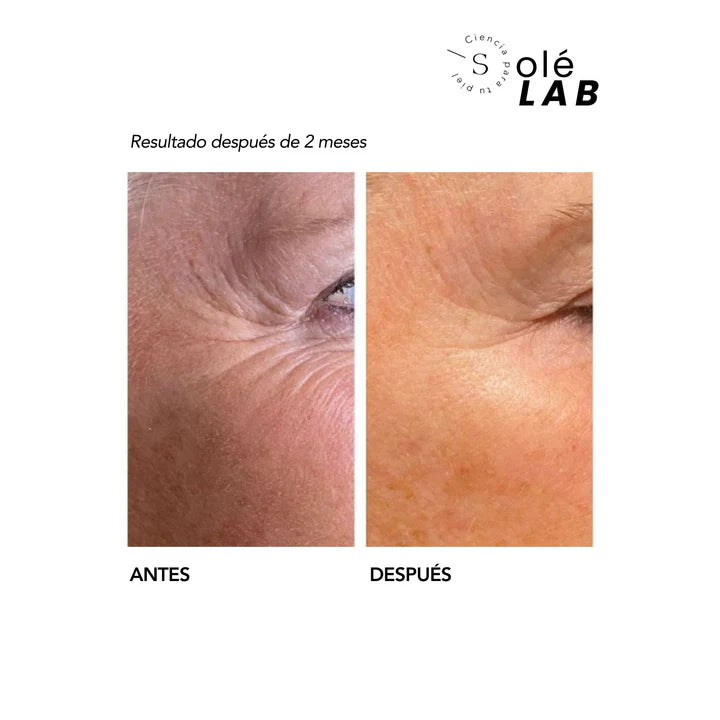 💧⭐ Retinol